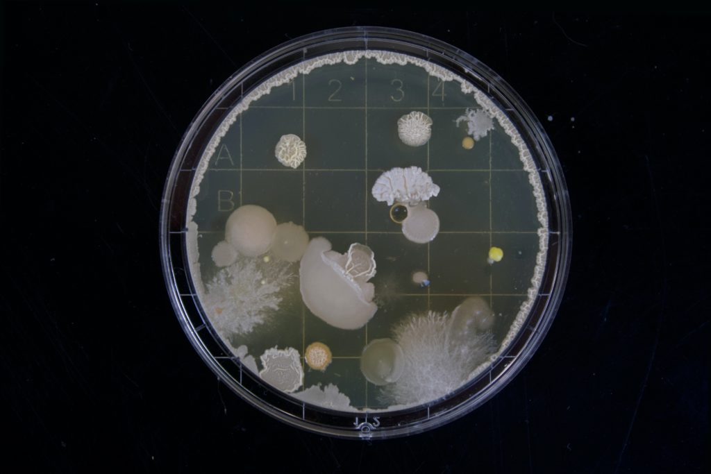 microbes in a petri dish